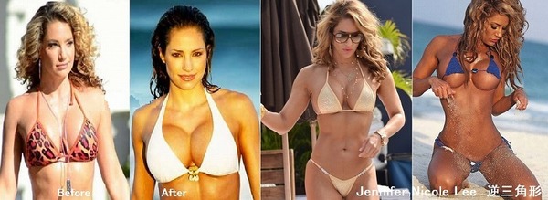 Implants_Jennifer.jpg