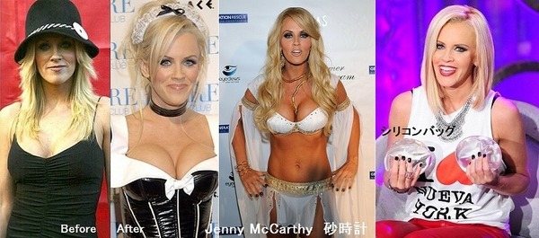 Implants_Jenny.jpg