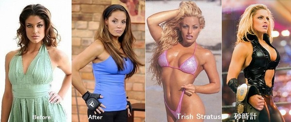 Implants_Trish.jpg